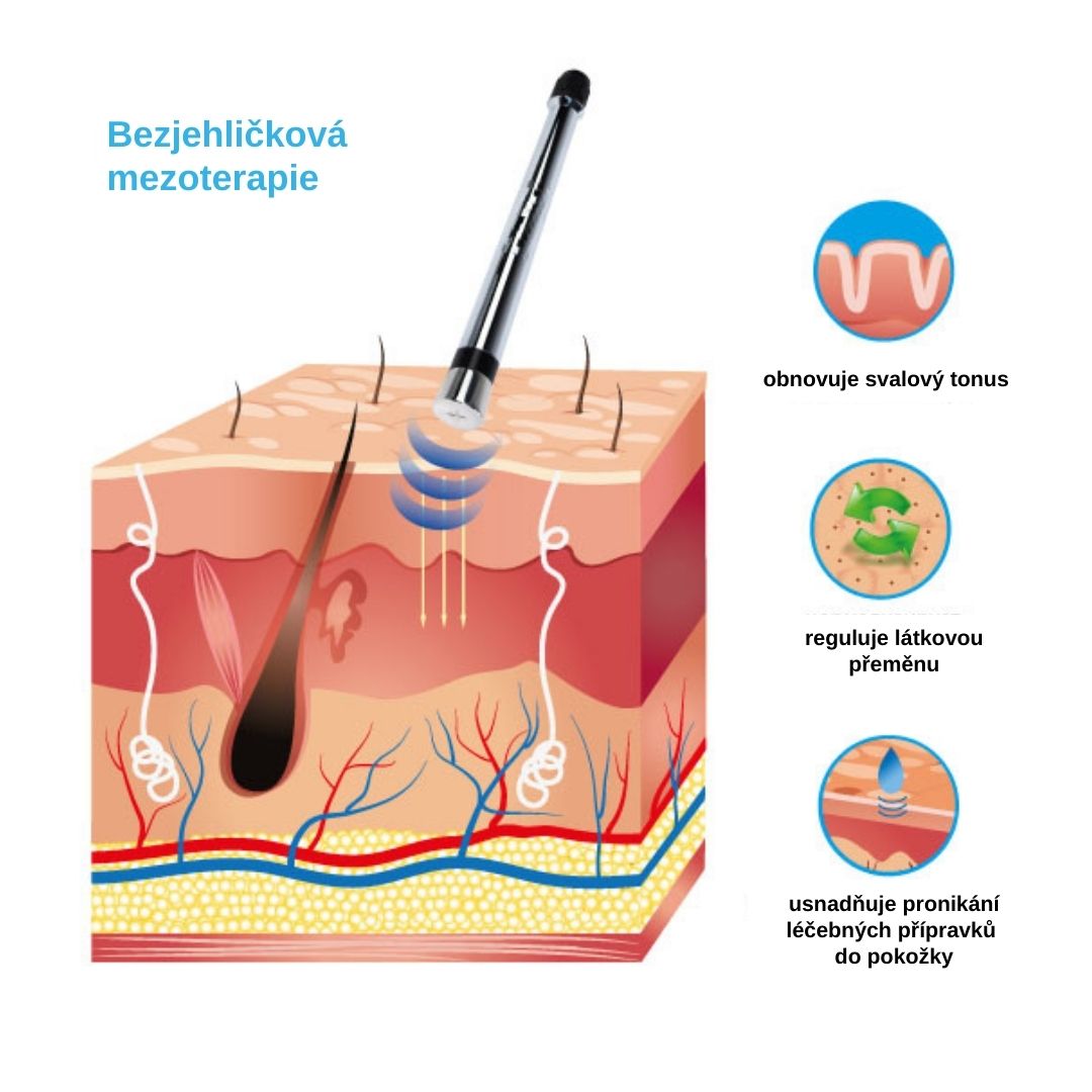 kosmetické přístroje kosmetický přístroj neinvazivní mezoterapie t-12 neinvazivní mezoterapie kosmetický přístroj neinvazivní mezoterapie t-12 monofunkční kosmetické přístroje